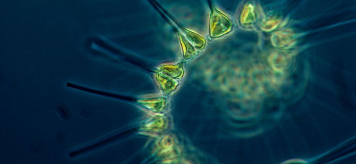 1280px-Phytoplankton_-_the_foundation_of_the_oceanic_food_chain